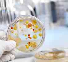 E. coli a baktérie přerůstání