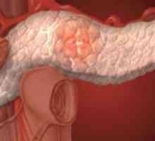 Cystické nádory pankreatu