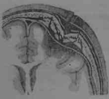 Klasifikace střelných poranění lebky a mozku