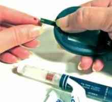 Klasifikace diabetes mellitus