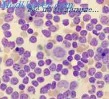 Kolonizace periferních lymfatických orgánů. lymfocyt repopulation