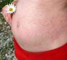 Kožní vyrážky v těhotenství