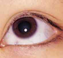 Boundary rohovky oka: léčba, příčiny, příznaky