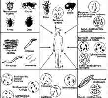 Laboratorní diagnostika střevní parazitární infekce a protozoozov