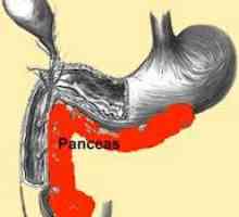 Léčení pankreatitidy (pankreatu), v akutním stadiu