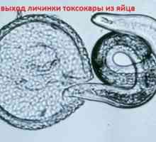 Larvy a vajíčka Toxocara viscerální larvální toxokaróza