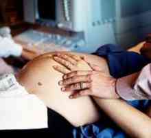 Listerióza v těhotenství, příznaky, léčba