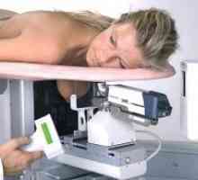 Mamografie prsu, když mám dělat?