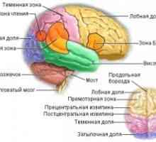 Metastatické nádory mozku
