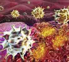 Metastázy rakoviny žaludku, mnozí s nimi žít, způsob metastáz