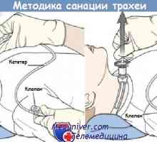 Způsob sání-tracheální, endotracheální trubice