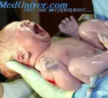 Přechod do spontánního dýchání novorozence. Vyhlazení plíce po porodu