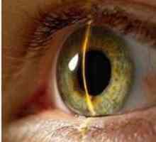 Myelinizace nervových vláken zrakového cesty
