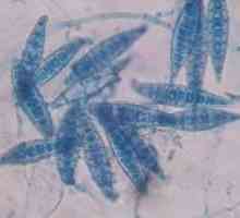 Mikrosporidiózy u člověka: příznaky, léčba