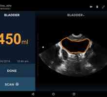 Miniaturní ultrazvukový skener pro urology