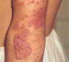 Miniatlas: kožní onemocnění doprovázené svěděním