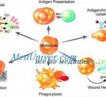 Dysfunkce monocytů a makrofágů imunity