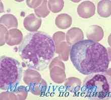 Porušení T-lymfocyty. CD8 lymfopenie