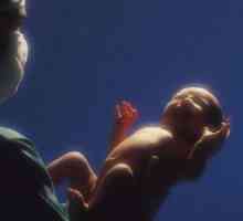 Non-infekční onemocnění kůže, podkoží, pupeční a pupeční rány bilance u novorozenců