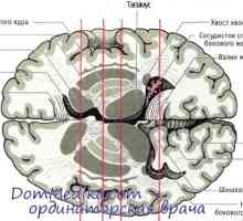 Neurotransmitery jsou bazální ganglia. Parkinsonova choroba