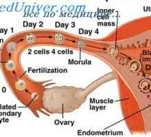 Abnormální umístěte implantaci embrya. Vaječníků a břišní těhotenství