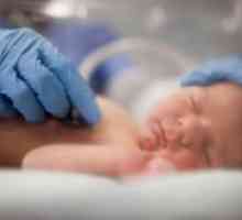 Novorozenecké péče o novorozence