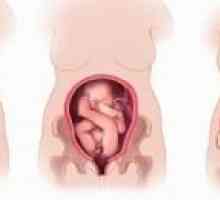 Špatného postavení a prezentace plodu během těhotenství