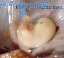 FIELD nohy fetálního mozku. Vývoj plodu epithalamus