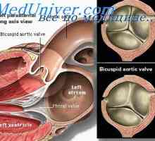 Vzdělání aortální ventily. Oddělování plodu arteriální kufru