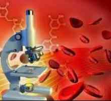 Kompletní krevní obraz s pankreatitida, leukocyty, ESR