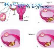 Zkouška děloha. Vyšetření pánevní dutiny s mimoděložním těhotenstvím