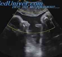 Diskutujte bezpečnost ultrazvukového použití. Účinek ultrazvuku na tkáň