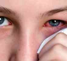 Ophthalmoherpes: léčba, symptomy