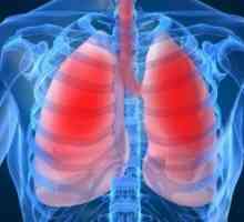 Nádory dýchacích cest: léčba, příznaky, diagnóza