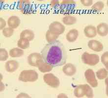 Imunita tělo. lymfatické tkáně