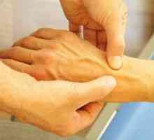 Artróza zápěstí: Prostředky pro léčbu, příčiny, příznaky, znaky