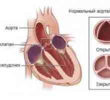 Akutní dysfunkce srdečních chlopní