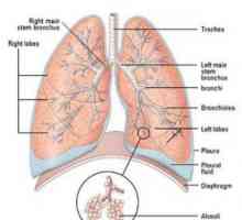 Akutní plicní absces