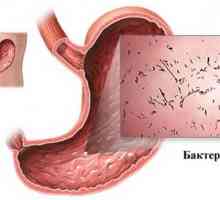 Akutní infekční gastroenteritida