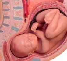 Odtržení placenty během těhotenství: příznaky, příčiny, léčba, příznaky, komplikace