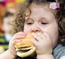 Obezita u dětí: léčba, příčiny, strava, prevence