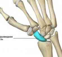 Zlomenina člunkové kosti kartáčem: Léčba