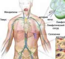 Primární nervový systém lymfom centrálního