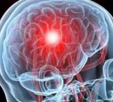 Primární lymfom mozku