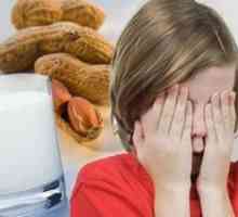Potravinové alergie u dětí starších než 7 let