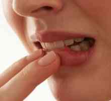 Spinocelulární karcinom ústní dutiny: léčba, příznaky, prognóza