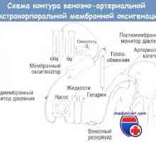 Komplikace mimotělní membránové oxygenace (ECMO)