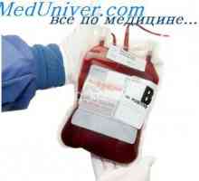 Indikace a kontraindikace pro mobilní transfuzi červených krvinek u novorozenců