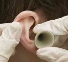 Porážka ucho: při příjmu drogy s herpes zoster