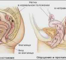 Malformace dělohy: diagnostika a léčba